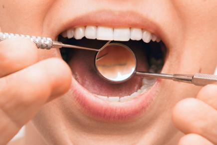 Traitement des caries à Charleroi Traitement des caries à Charleroi